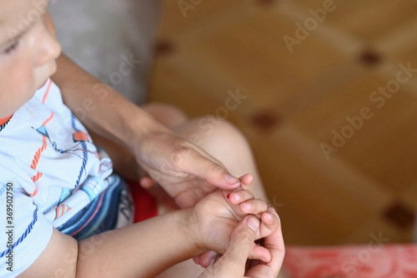 Fototapeta the child is bleeding from a finger
