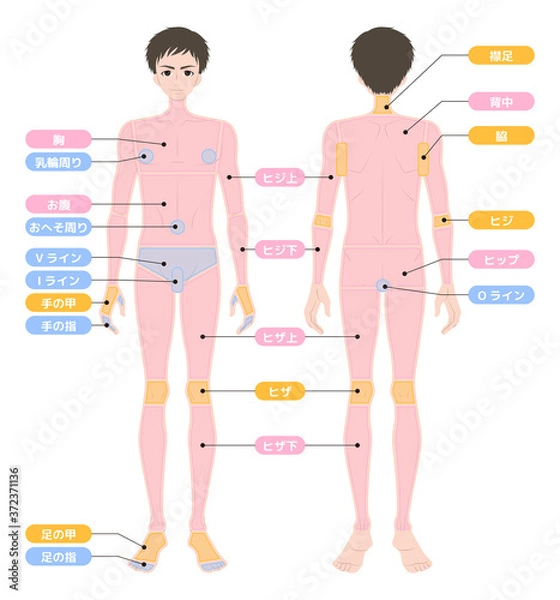 Obraz 脱毛箇所　全身　男性