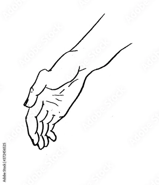 Fototapeta Broken finger in the old book The doctrine of fractures and dislocations by Nemmert, St. Petersburg, 1851