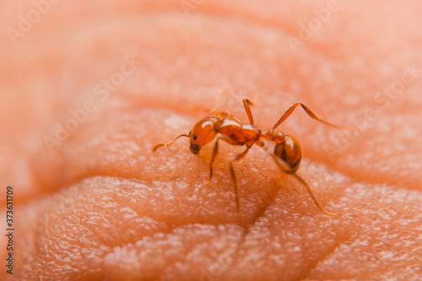 Obraz red ant bite finger