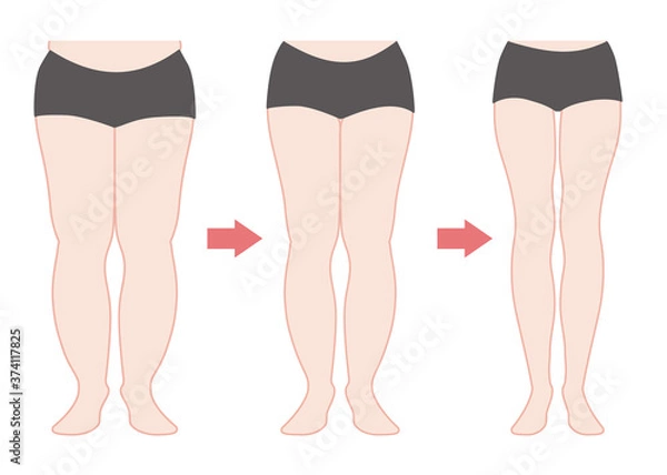 Fototapeta ダイエットの経過　脚やせ　カラー