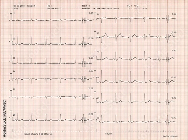 Obraz Electrocardiogramme