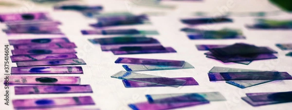 Obraz stained glass slides of peripheral blood smear with violet leishman giemsa stain in hematology pathology laboratory