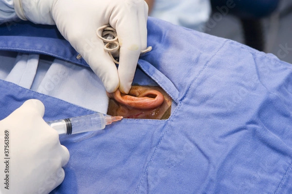 Obraz Surgeon Performing Surgery