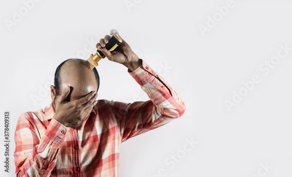 Obraz bald man covering his face and applying hair grow oil in white background with space for text