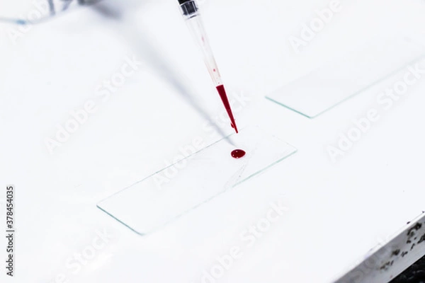 Obraz drop of blood on a glass slide using micropipette microtip