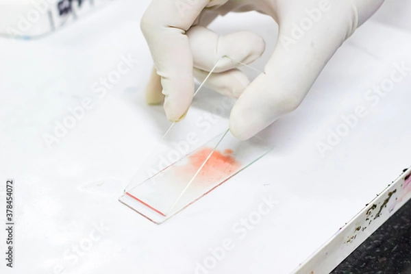 Obraz smear drawing of blood by glass slide