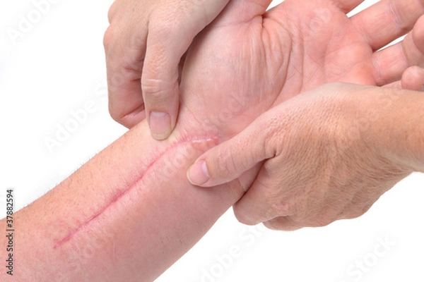 Obraz Therapy Massage