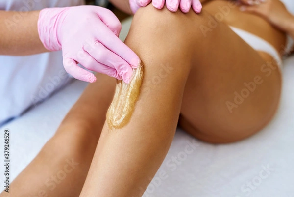 Fototapeta Woman is applying epilation sugar paste. The hair removal procedure on the white background