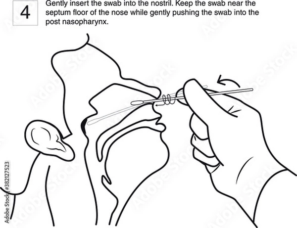 Fototapeta Gently insert the swab into the nostril. Keep the swab near the septum floor of the nose while gently pushing the swab into the post nasopharynx. step 4, line drawing