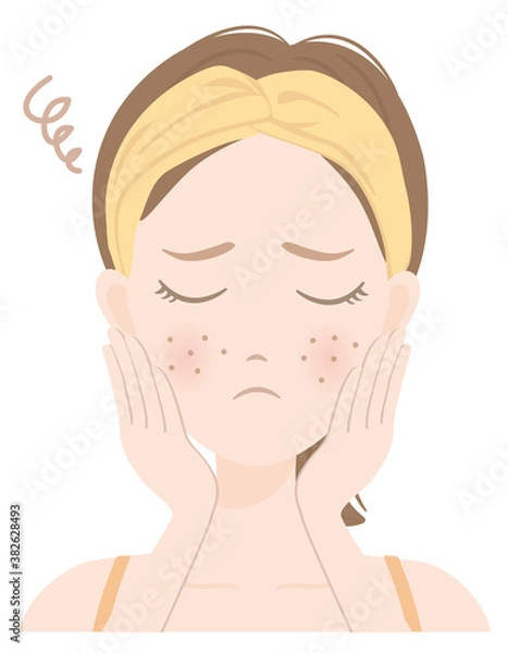 Fototapeta スキンケアをしている女性（肌荒れ）