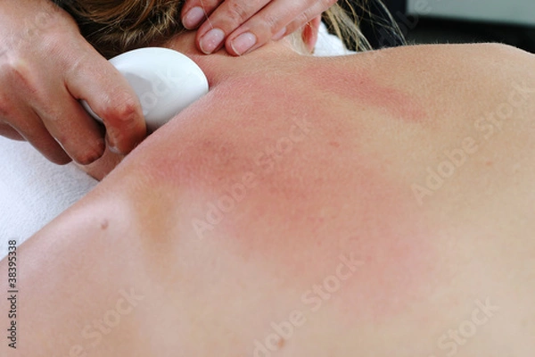 Obraz Gua Sha treatment