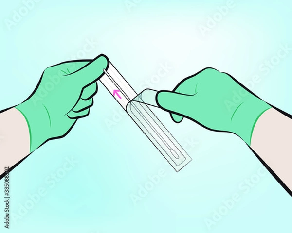Fototapeta Step 2 : Open the collection swab wrapper by peeling open the top of the wrapper. Remove the swab, taking care not to touch the tip of the swab or lay it down.