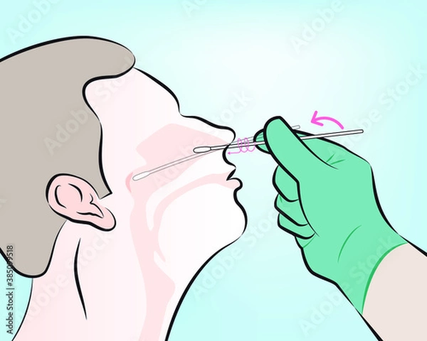 Fototapeta step 4 : Gently insert the swab into the nostril. Keep the swab near the septum floor of the nose while gently pushing the swab into the post nasopharynx.