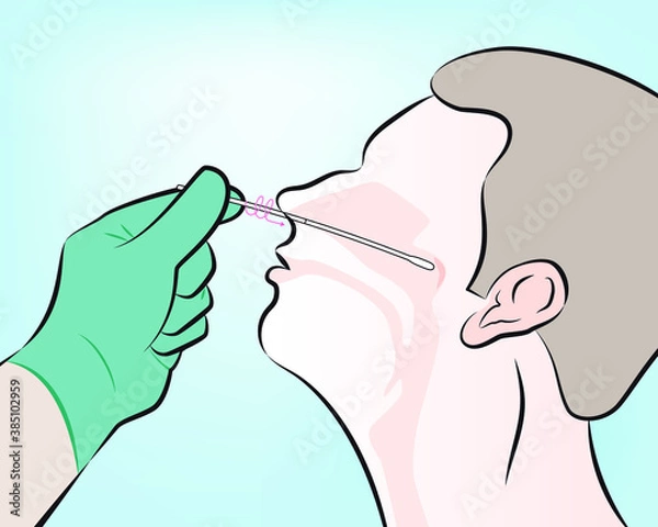 Fototapeta Step 5 : As a visual reference, the swab should be inserted about half the distance from the opening of the patient’s nostril and the ear. Rotate the swab several times.