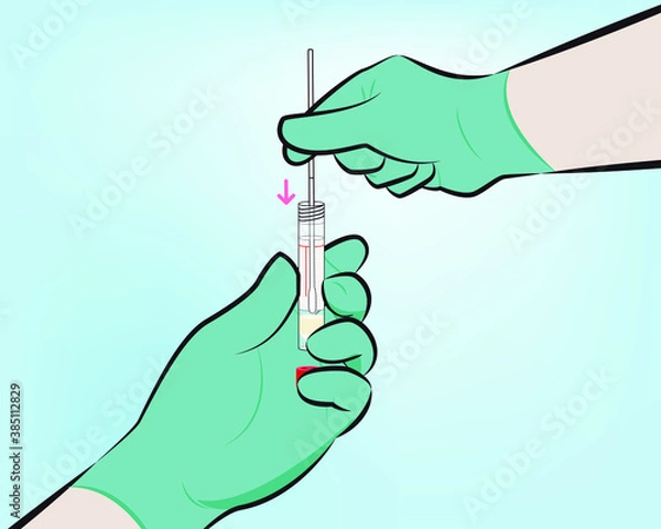Fototapeta Step 6 : While holding the swab in the same hand, aseptically remove the cap from the tube. Insert the swab into the tube with the transport medium.