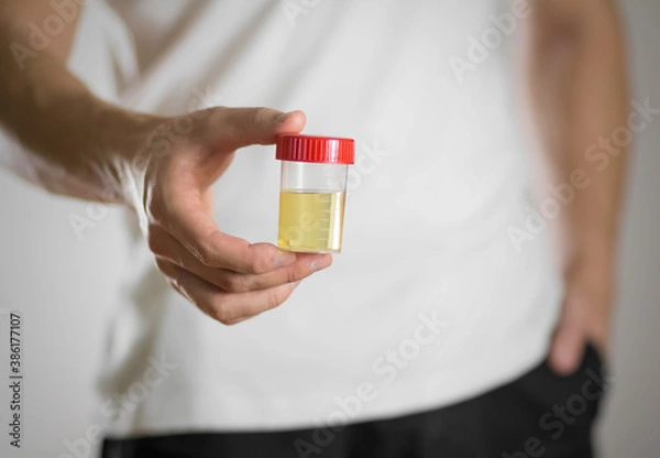 Fototapeta A man holds a jar with a urine test. Close up