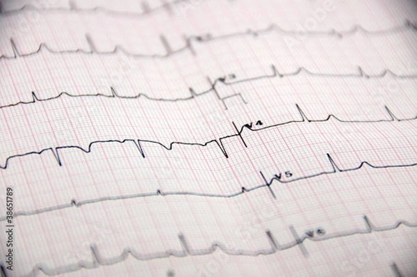 Obraz EKG-Whore