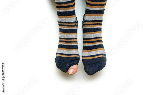 Fototapeta The feet with well worn striped socks isolated on a white background. One has a hole and a toe through it. 