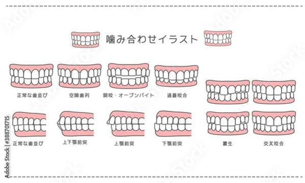 Fototapeta 歯科_歯科矯正・歯並び・噛み合わせ一覧 