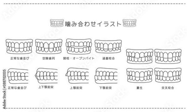 Obraz 歯科_歯科矯正・歯並び・噛み合わせ白黒