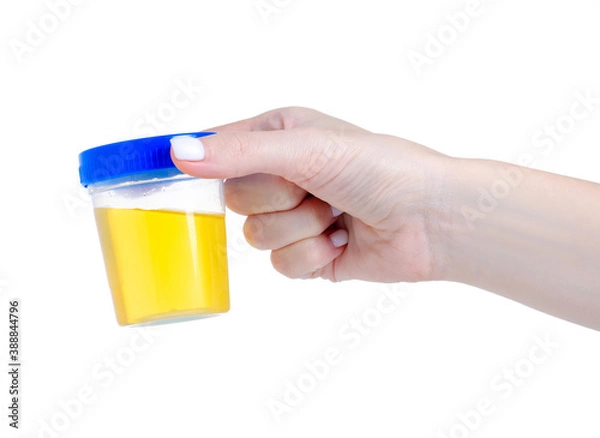 Obraz container for urine analysis in hand on white background isolation