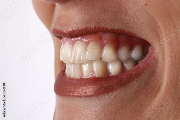 Obraz Szlifować zęby