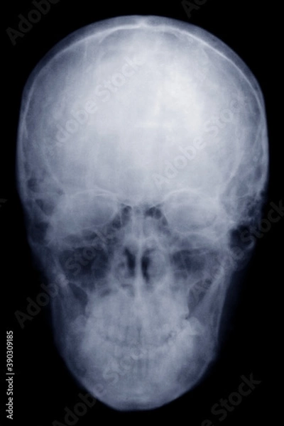 Obraz the man's skull. x-ray.