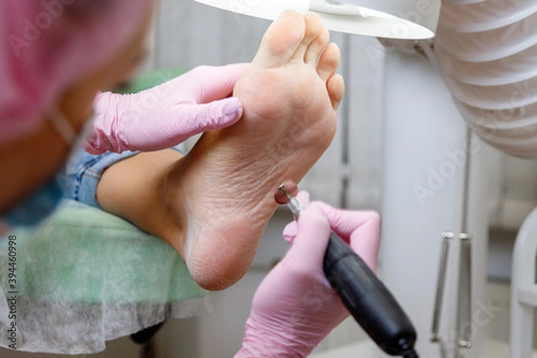 Obraz Professional hardware pedicure using electric machine. Patient on medical pedicure procedure with abrasive disc at home studio