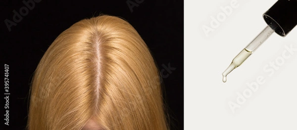 Obraz The woman's head on top, hair parted in the middle. Pipette cosmetics, skin care oil for hair.