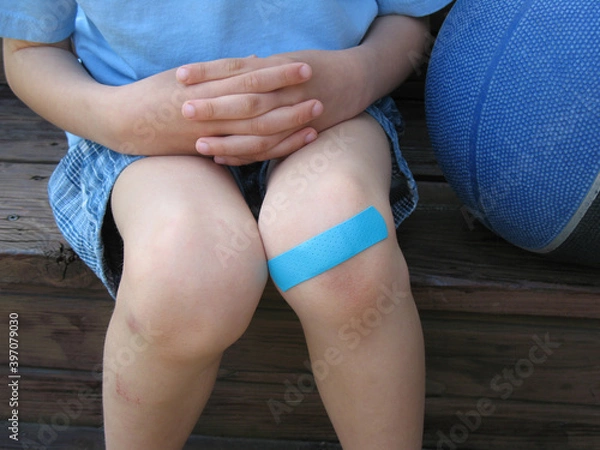 Obraz Child with a bruised knee