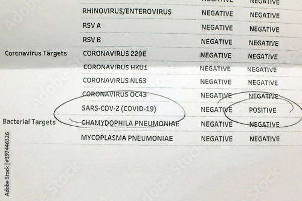 Obraz A positive test result for Covid 19