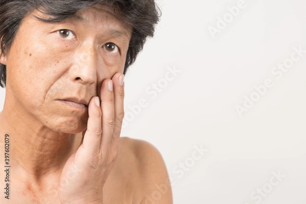 Obraz シミ、しわがある、上半身裸の中年男性