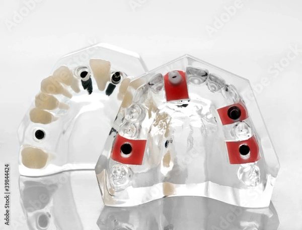 Obraz artificial jaw