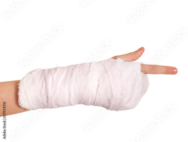 Fototapeta Broken arm in a cast