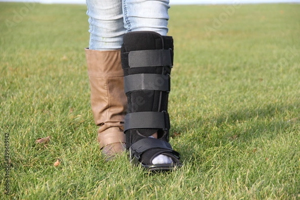 Obraz cast boot on leg