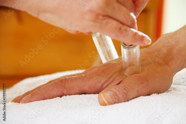 Obraz Masaż bańkami