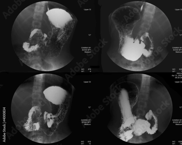 Obraz Stomach Radiology