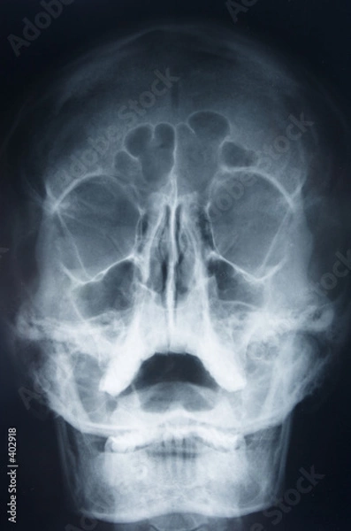 Fototapeta head x-ray