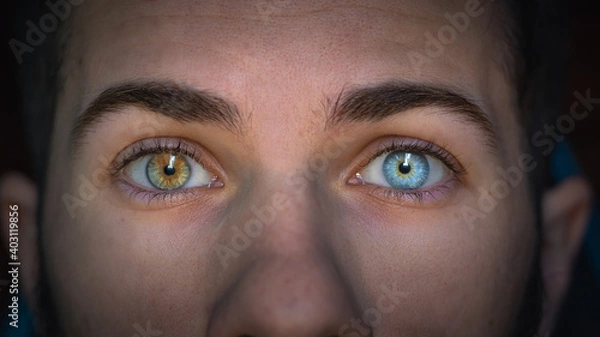 Fototapeta close up portrait of a person with heterochromie