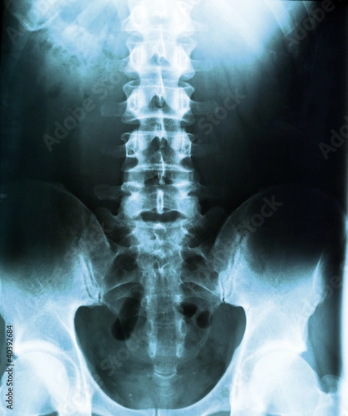 Obraz human body on x-ray
