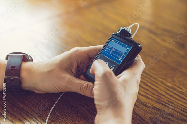 Fototapeta Modern diabetes treatment, woman checking glucose level and dosing insulin using insulin pump