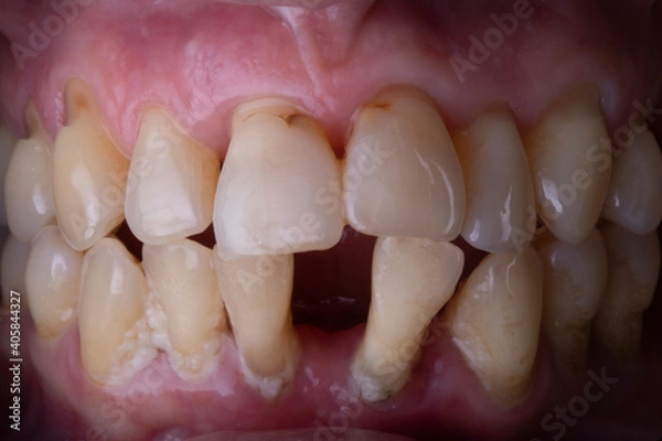 Obraz human teeth, teeth ache needs to be treated.