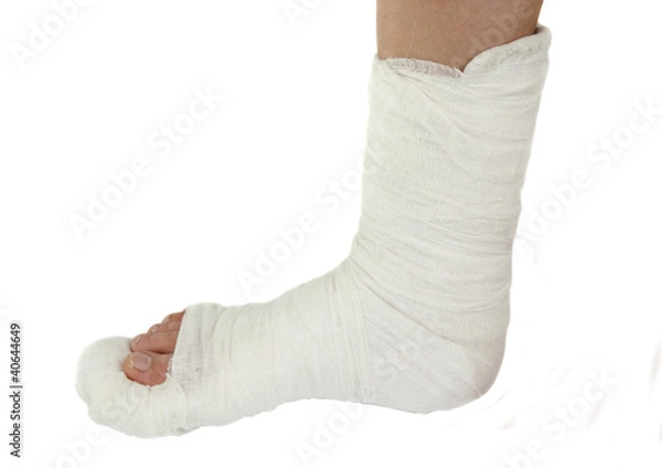 Obraz leg in a plaster cast