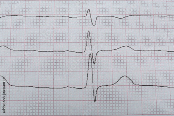 Fototapeta Cardiogram report as background, closeup. Heart diagnosis