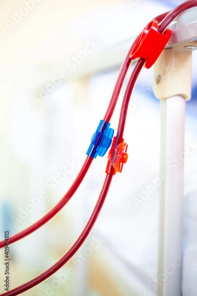 Obraz Dialysis Device In The Hospital