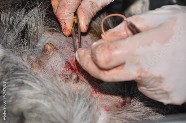 Obraz surgical operation to remove the uterus