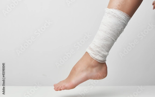 Obraz bandaged leg injury medicine gray background problems