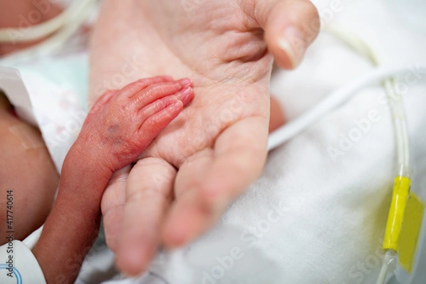 Obraz Newborn neonatal infant pulse oximeter premature baby.