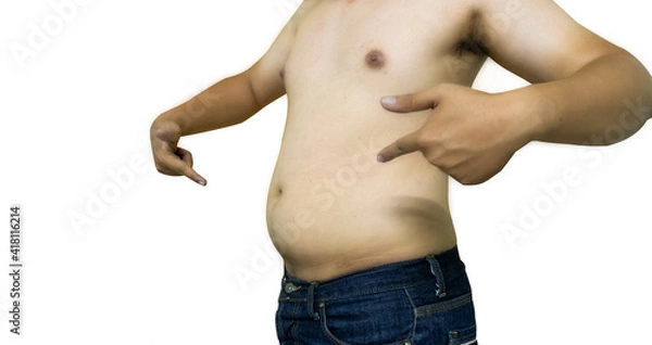 Fototapeta Asian fat man has overweight on white background